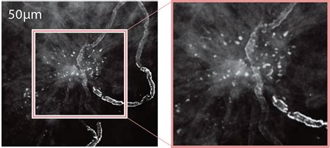 AMULET Innovality : Advanced Biopsy System .